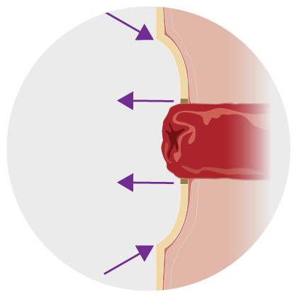 Better seal with convexity